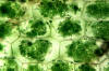 Elodea with cells plasmolyzed