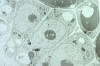 cells of resin secreting gland of cottonwood