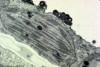 cottonwood chloroplast with lipid drops
