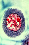 nucleus before start of meiosis