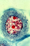 meiosis, early prophase I