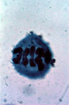 meiosis, late in metaphase I