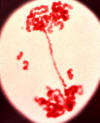 end of anaphase II, irradiated cell