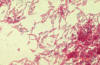 bacterial endospores