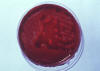 bacterial colonies on blood agar