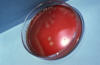 bacterial colonies on blood agar