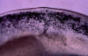 Rhizopus culture closeup showing sporangia