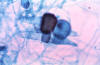 Rhizopus zygospores and hyphae