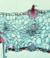 barberry leaf cross section with wheat rust spermatia below and receptive hyphae above