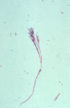 Penicillium sporangium