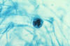 Saprolegnia oogonium and antheridia