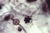 Saprolegnia oogonia and antheridia