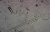 living diatoms