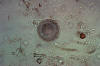diatom closeup (Centrales)