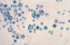 Protococcus (Pleurococcus) lm