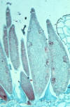 liverwort gemmae closeup