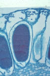 liverwort antheridium closeup