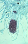 liverwort sporophyte with foot, seta, capsule, and spores