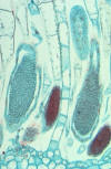 moss antheridia cross section closeup