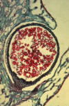Selaginella microsporangium section