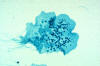 fern prothallus with rhizoids on left and many antheridia elsewhere