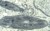 chloroplasts (electron micrograph)
