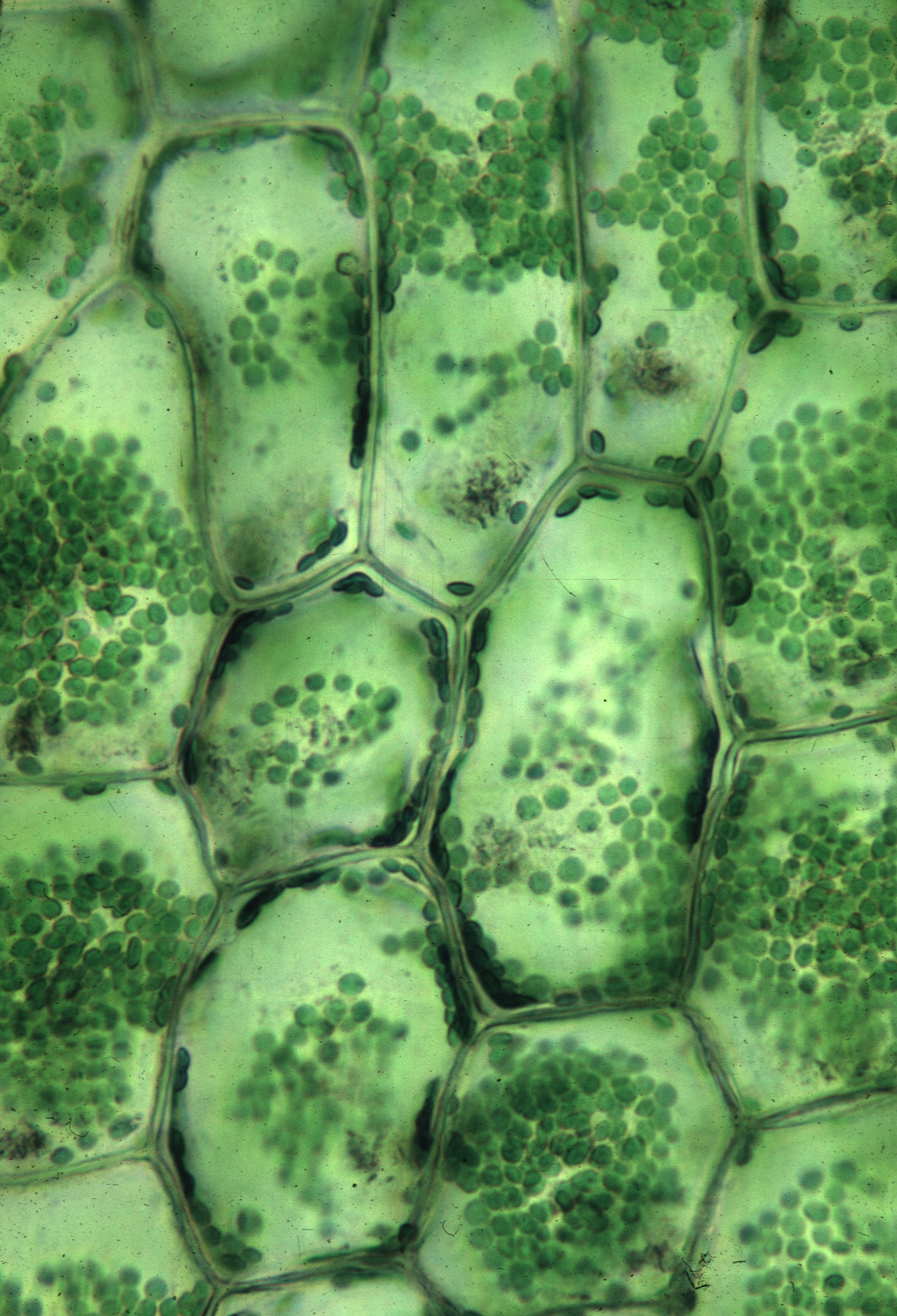 В клетках мякоти листа. Клетки фотосинтезирующей ткани элодеи. Клетка элодеи. Устьица элодеи. Клетки листа элодеи.