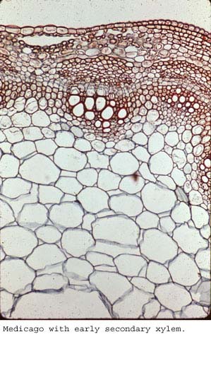 Anat0162