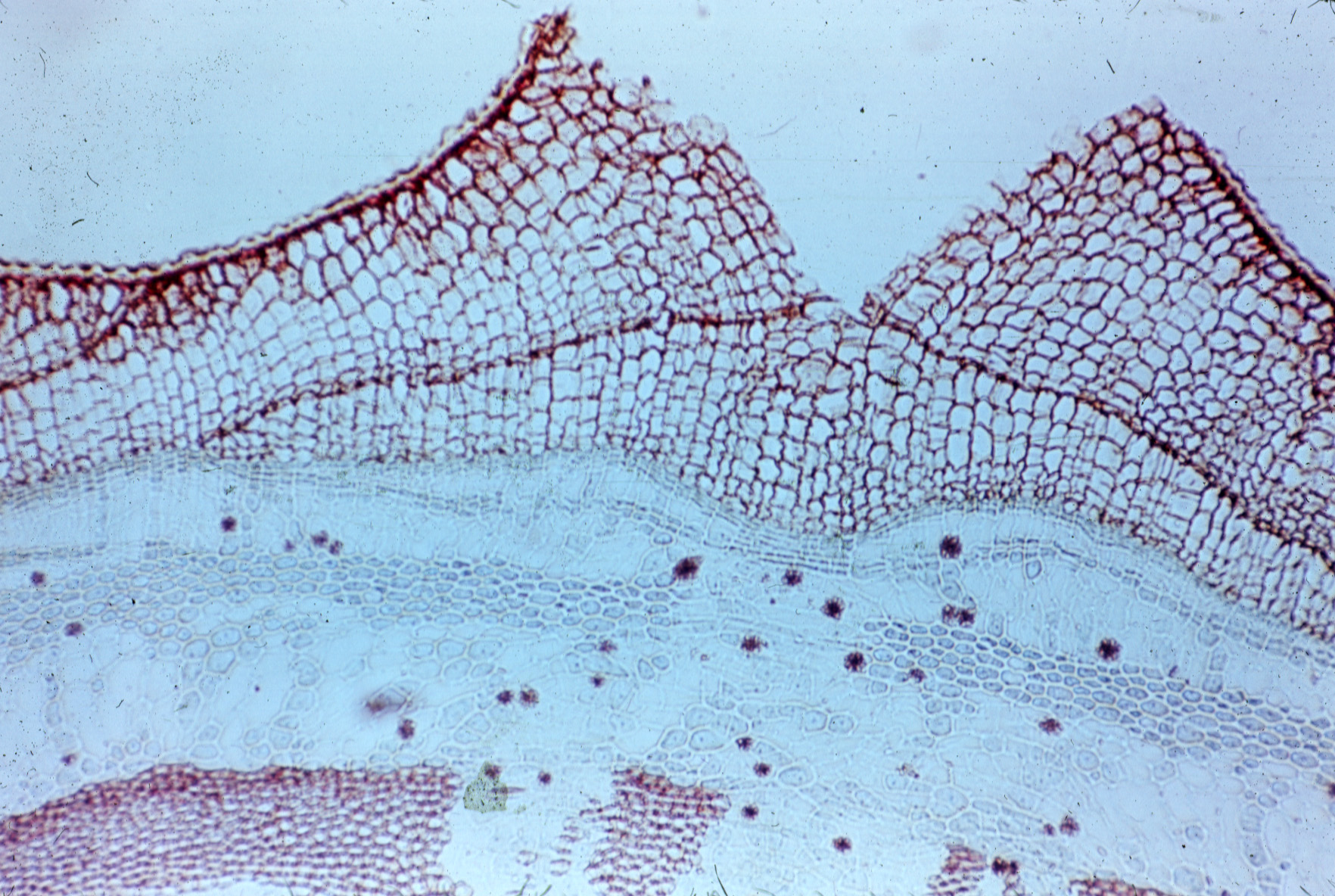 Чечевичка бузины под микроскопом