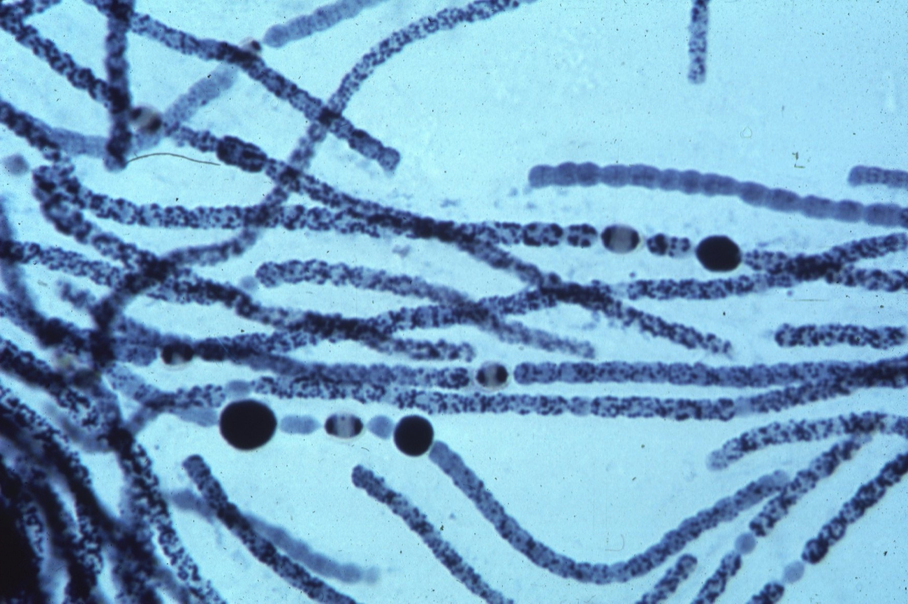 Группы организмов цианобактерии. Цианобактерия Анабена. Синезеленые водоросли цианобактерии. Нитчатые цианобактерии. Прокариотические цианобактерии.
