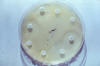 gram negative bacteria antibiotic resistance assay