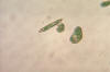 living Euglena, good for shape variation