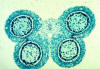lily anther cross section, many microspore mother cells undergoing meiosis, lm