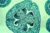 lily ovary cross section with some ovules at time of megaspore mother cell meiosis